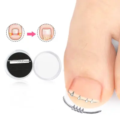 Korektor za vraščene nohte Silver