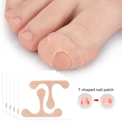 Obliži za korekcijo vraščenih nohtov na nogah